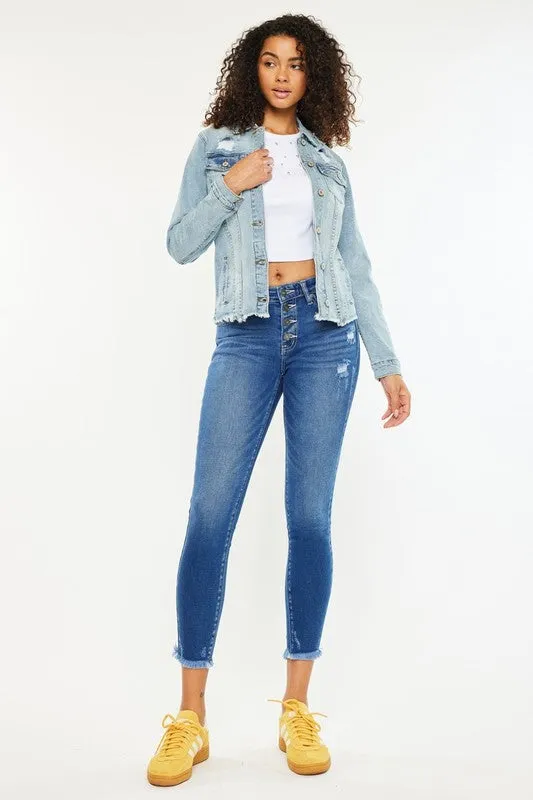 Mid-Rise Button Fly Ankle Skinny Jeans