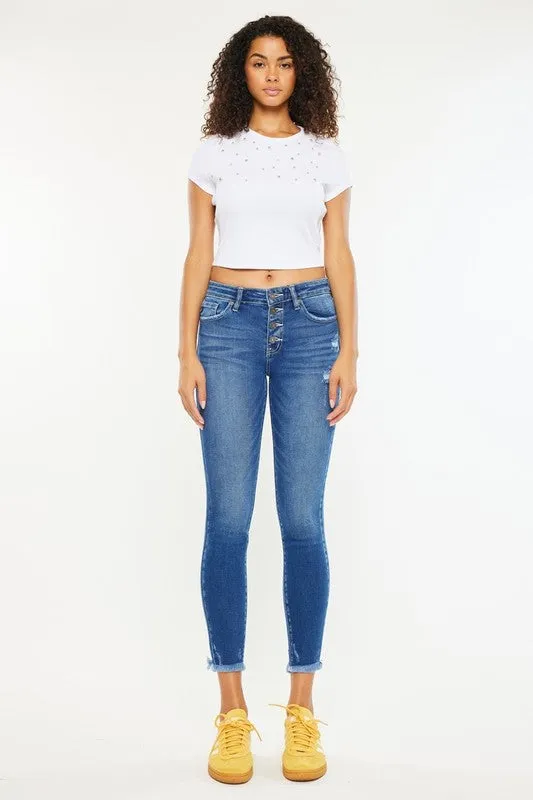 Mid-Rise Button Fly Ankle Skinny Jeans