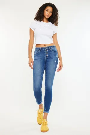 Mid-Rise Button Fly Ankle Skinny Jeans