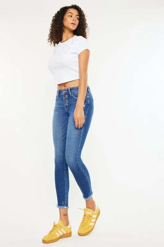 Mid-Rise Button Fly Ankle Skinny Jeans